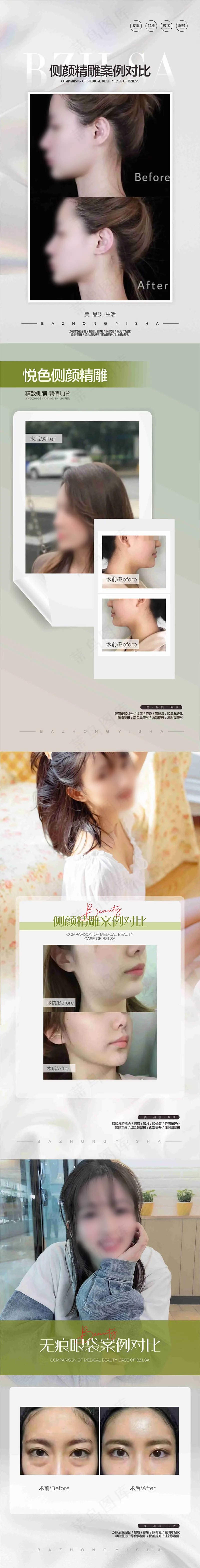 医美案例对比图cdr矢量模版下载