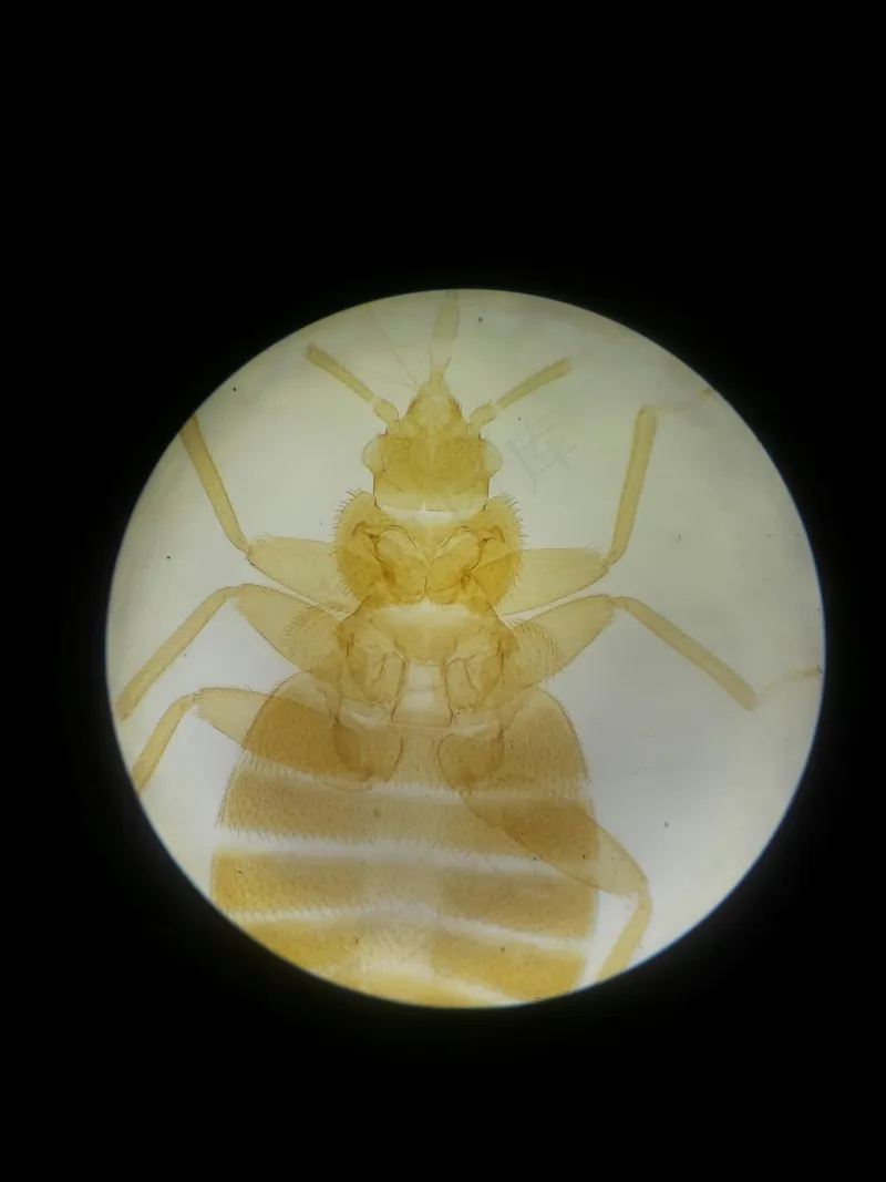 微观世界之床虱真相