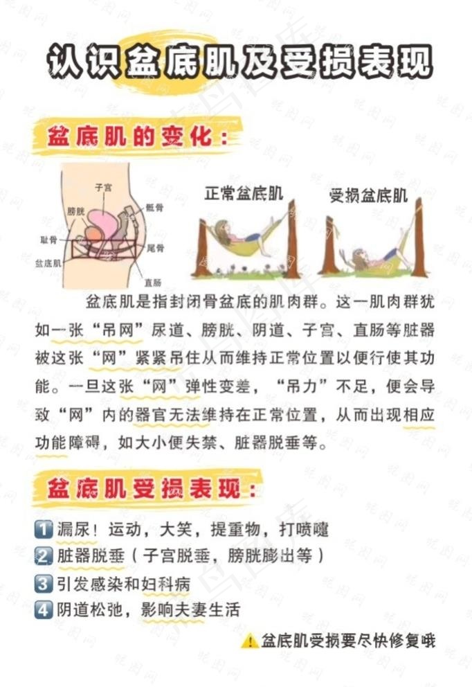 认识盆底肌及受损表现图片cdr矢量模版下载