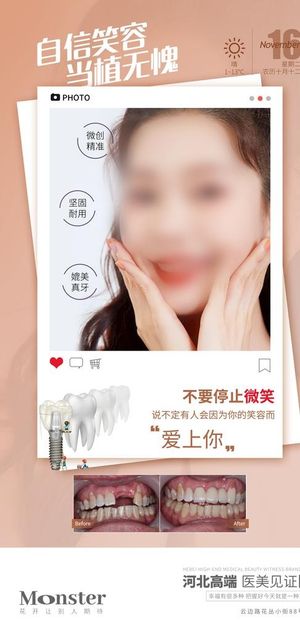 医美种植牙图片