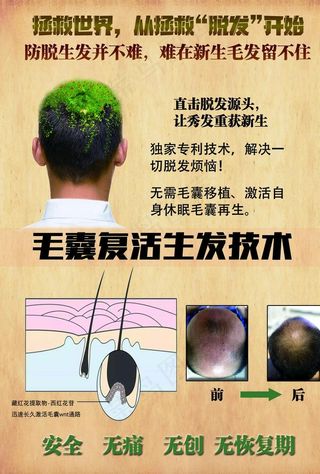 植发海报图片