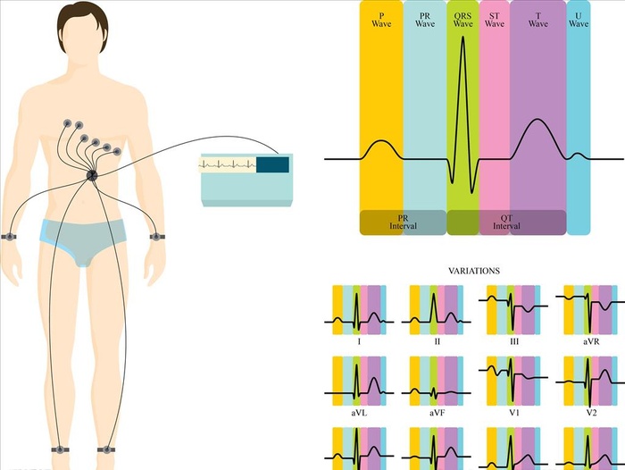 人体心电图图片ai矢量模版下载