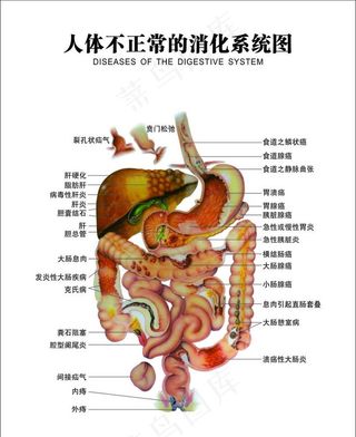 人体不正常的消化系统图图片