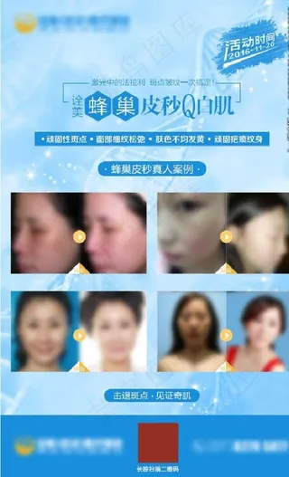 皮秒激光美容仪海报图片