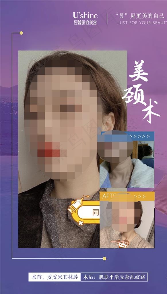 医美整形医院案例对比海报图片psd模版下载