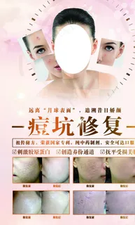 痘坑修复海报图片