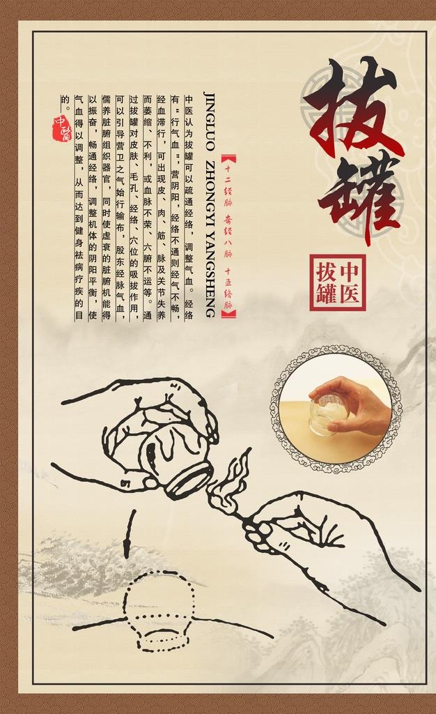 拔罐海报图片