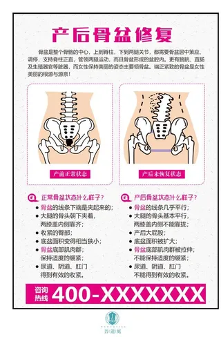 产后骨盆修复图片
