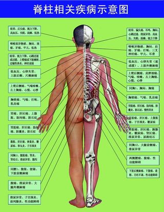 脊柱相关疾病示意图图片