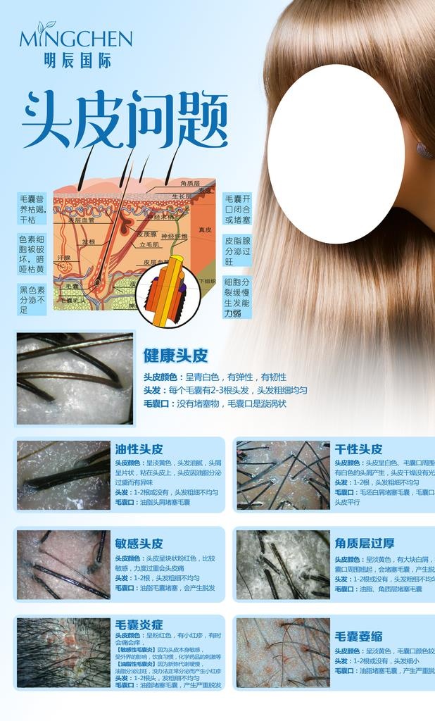 头皮问题图片