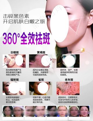 全效祛斑图片