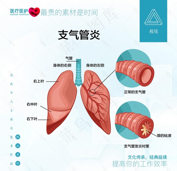 支气管炎图片ai矢量模版下载