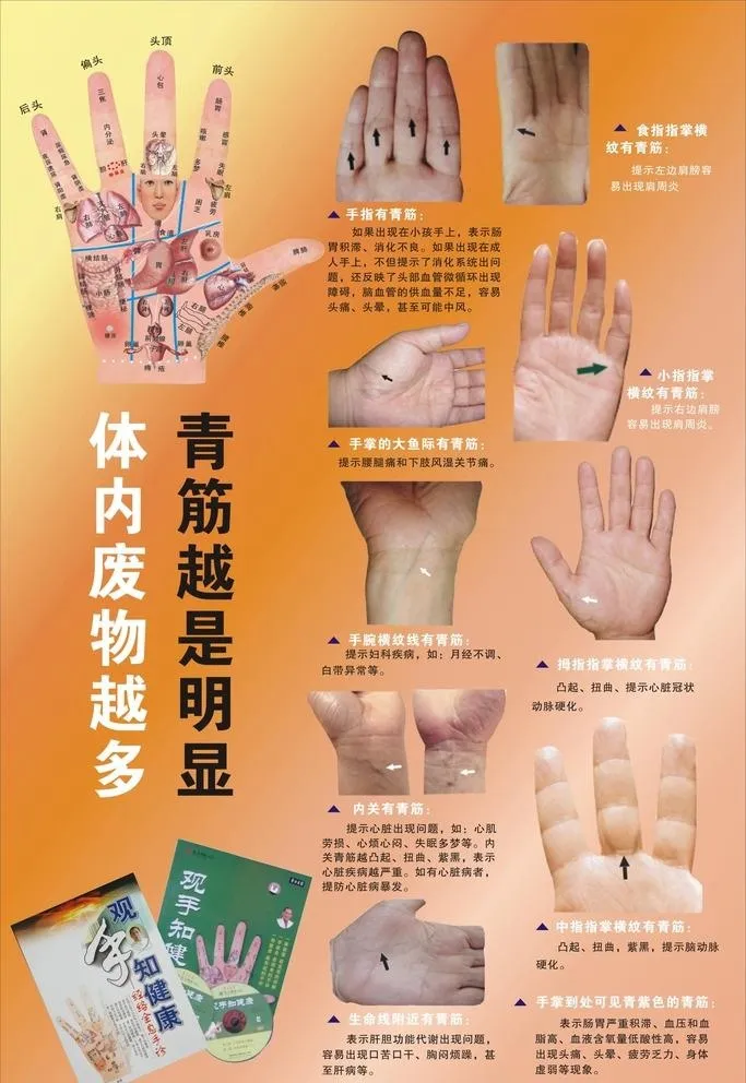 手诊展板图片cdr矢量模版下载