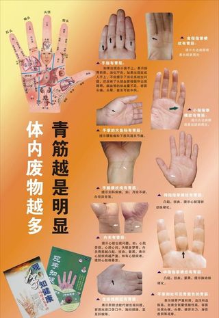 手诊展板图片