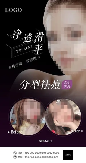 祛痘图片