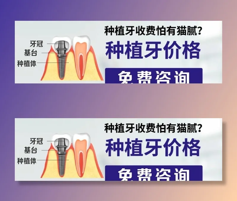 种植牙图片(1200x400)psd模版下载