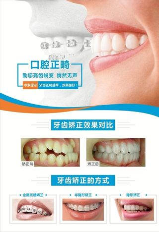 口腔正畸图片