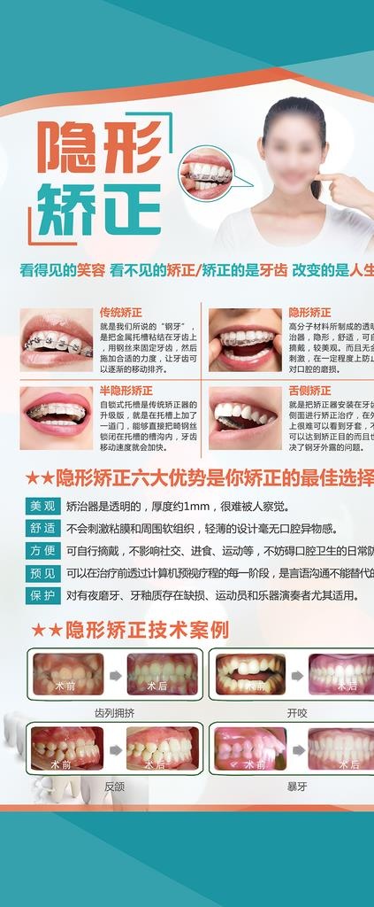 口腔医院牙齿矫正展架图片