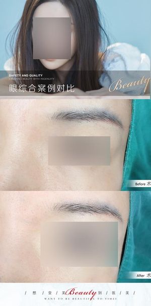 医美案例模板图片