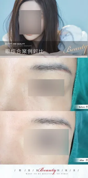 医美案例模板图片