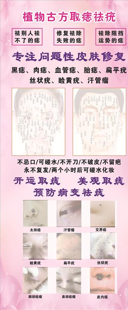 取痣祛疣图片cdr矢量模版下载