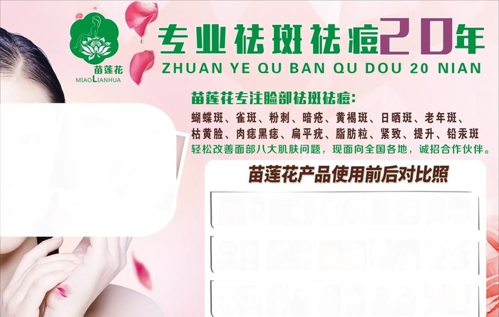 苗莲花祛斑祛痘图片
