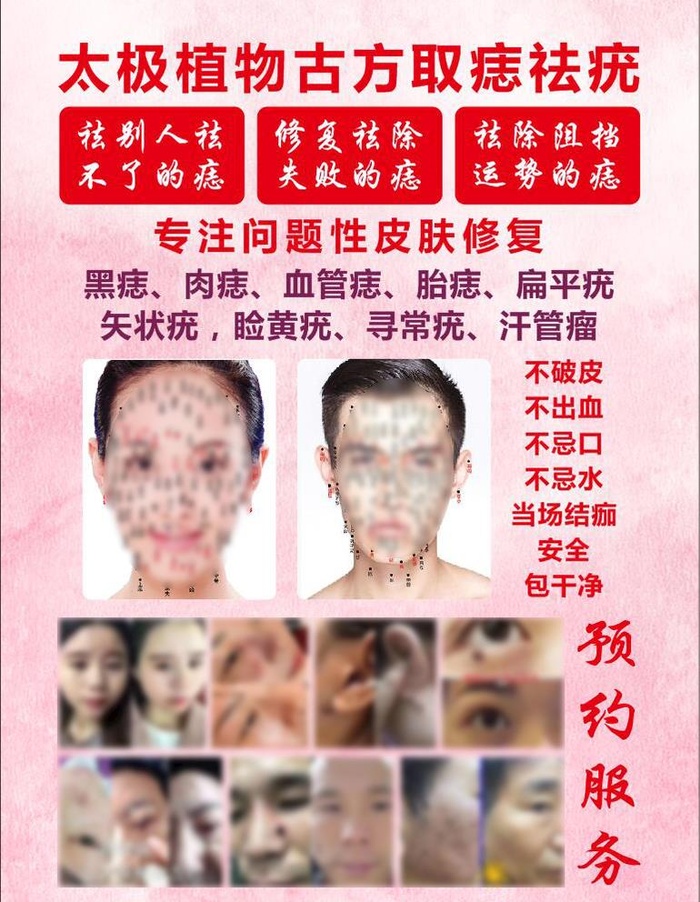 祛痣图片cdr矢量模版下载