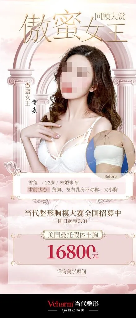 隆胸海报图片(1080x2348)psd模版下载