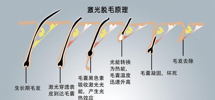 激光脱毛图片(3543x1772)psd模版下载