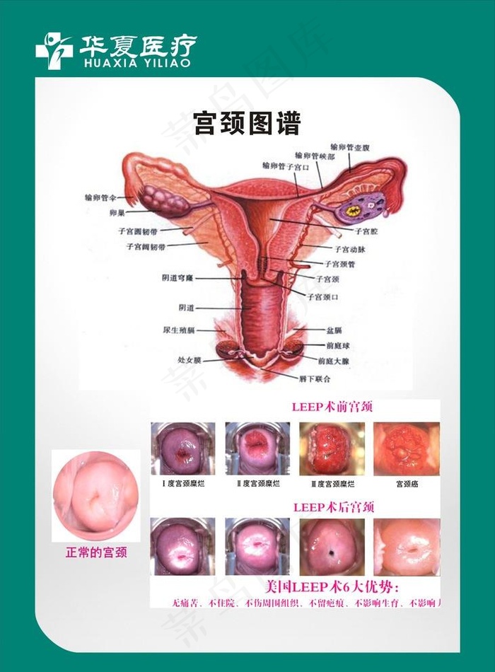 妇科 图谱 妇科生殖图片