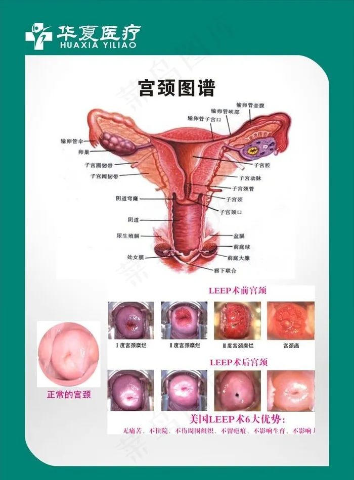 妇科 图谱 妇科生殖图片cdr矢量模版下载