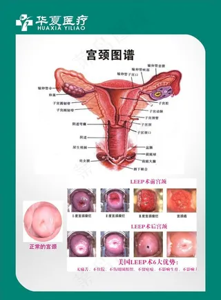 妇科 图谱 妇科生殖图片