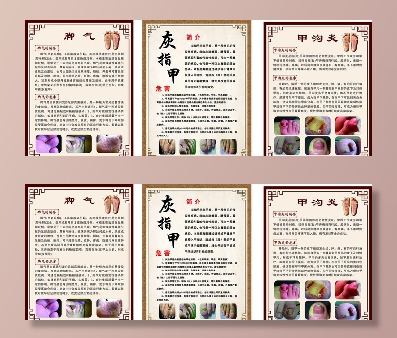 养生海报 灰指甲 甲沟炎 脚气图片