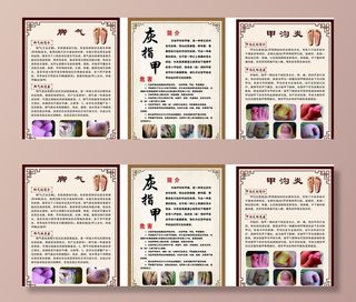 养生海报 灰指甲 甲沟炎 脚气图片