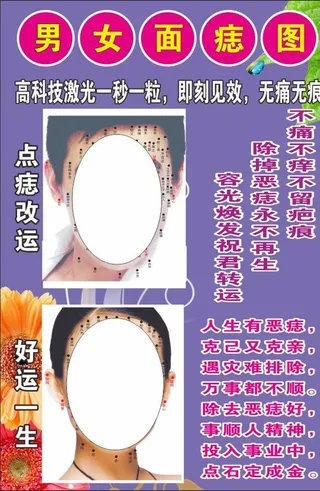 男女面痣图图片