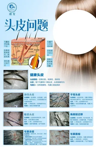 头发问题图片