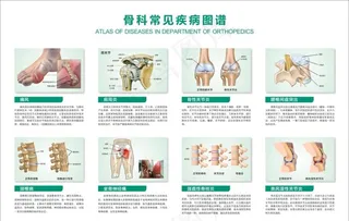 医院 骨科常见疾病图谱图片
