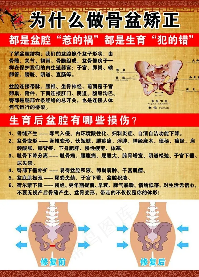 盆骨矫正海报图片psd模版下载