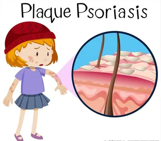 卡通儿童和皮炎图片