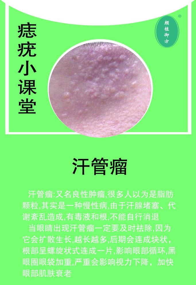 汗管瘤图片(2268x3402)psd模版下载