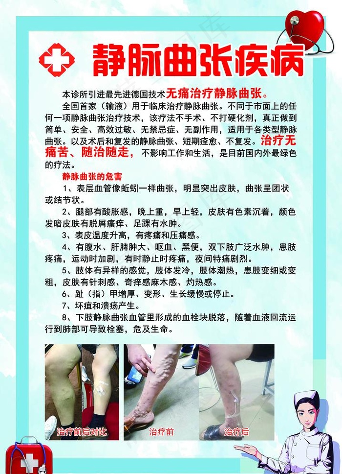 静脉曲张图片(2756x3937)psd模版下载