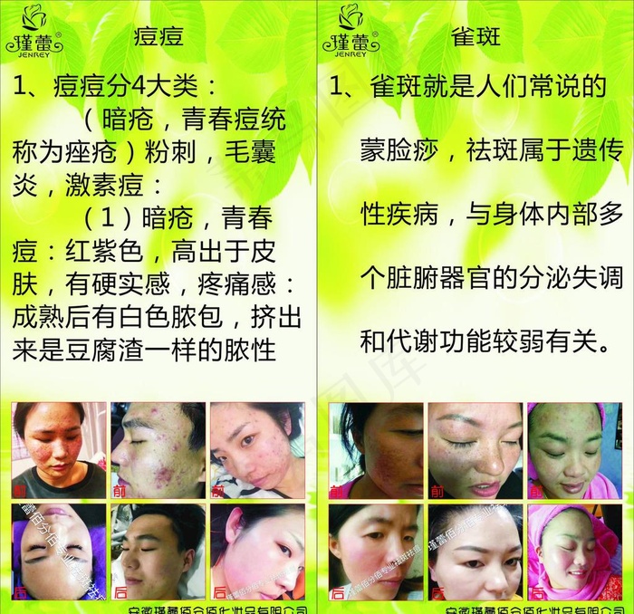祛痘祛斑图片cdr矢量模版下载