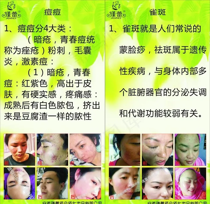 祛痘祛斑图片cdr矢量模版下载