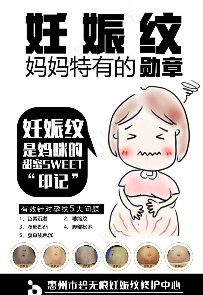 妊娠纹图片(1701x2551)psd模版下载