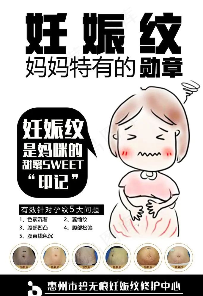 妊娠纹图片(1701x2551)psd模版下载