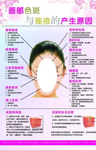 面部色斑与痤疮产生原因图片