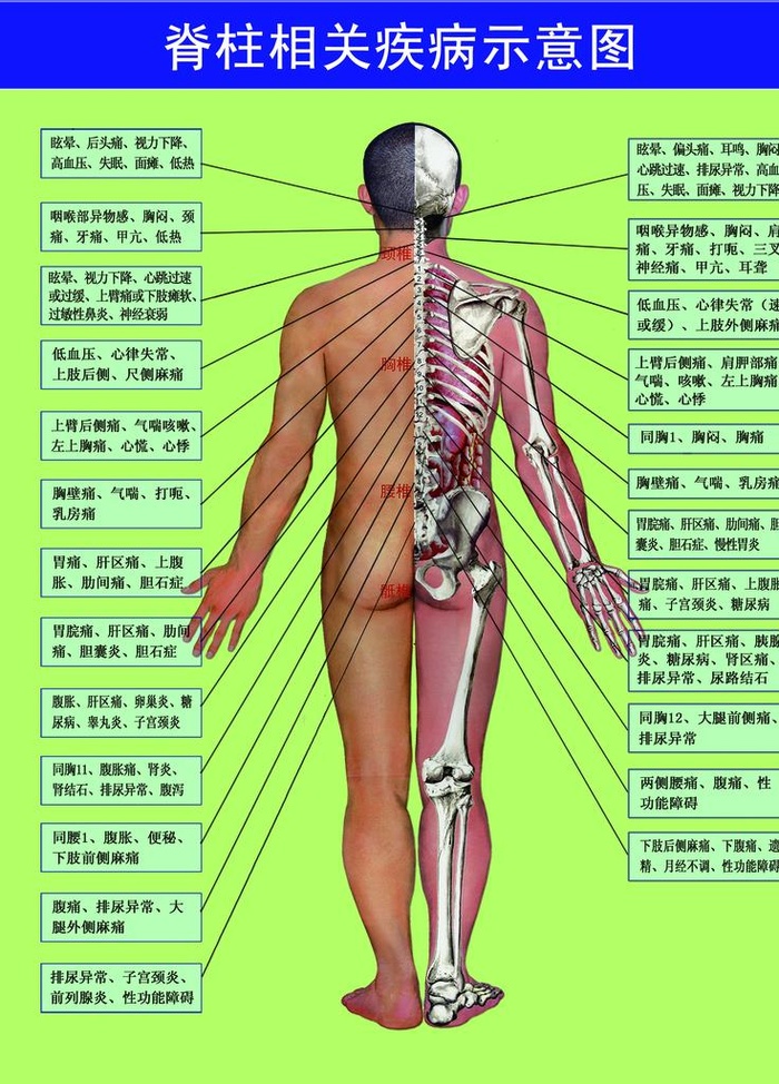 脊柱相关疾病示意图图片