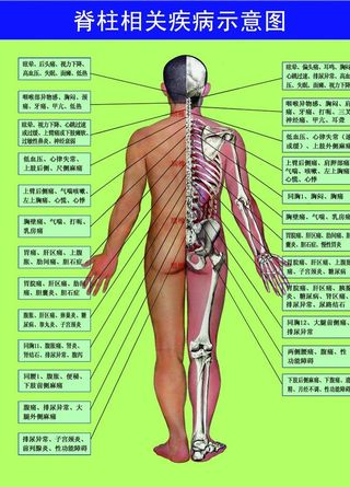 脊柱相关疾病示意图图片