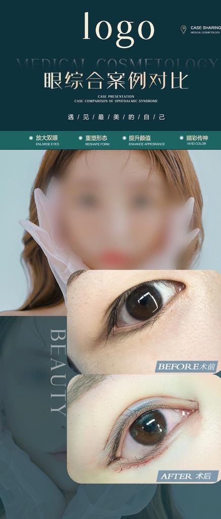 医美整形案例对比图片