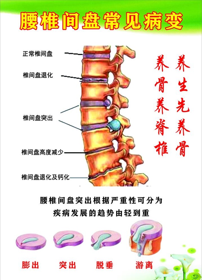 腰椎间盘常见病变图片cdr矢量模版下载